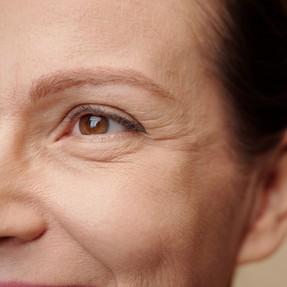 Ridules de déshydratation